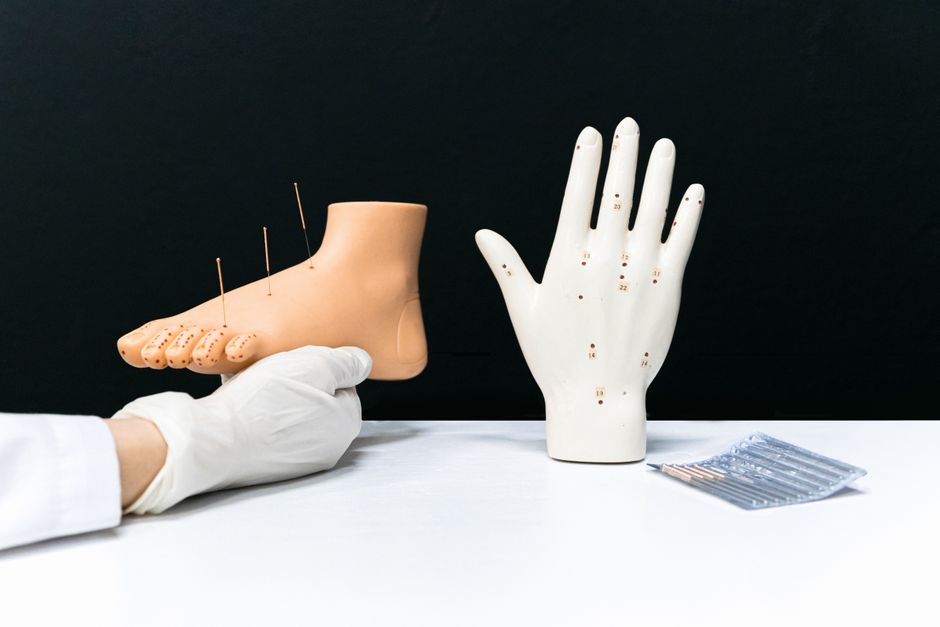Modèles d'acupuncture d'une main et d'un pied avec des aiguilles, mettant en avant des techniques de thérapie alternative.